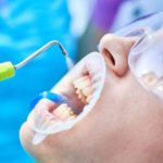 Как часто необходимо делать проф. чистку зубов?