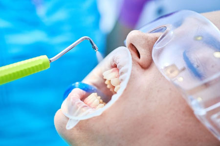Как часто необходимо делать проф. чистку зубов?